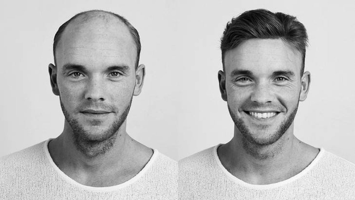 HAIR FOR LIFE - CONTACTSKIN
